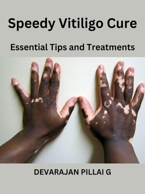 cover image of Speedy Vitiligo Cure